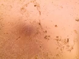 30,700 likes · 89 talking about this. Institut Pasteur Isolates Strains Of Coronavirus 2019 Ncov Detected In France Eurekalert Science News