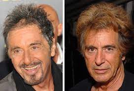 Hollywood Celebrities Before After Wearing Wigs