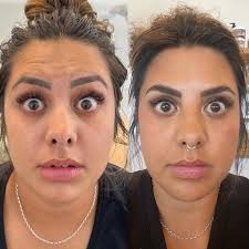 L I P • F L I P • W I T H • F I L L E R Have you been