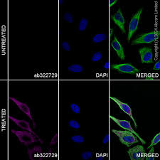 Image result for tbn:FViwq3jp39EDyM::www.alsowar.com/Upload/Molly/7625200870454.jpg