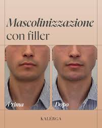 Vi presento il dott. Alessandro Carraro: medico estetico, il suo obiettivo  è realizzare a pieno il desiderio del paziente con trattamenti di medicina  estetica ad hoc. Prenota online la tua consulenza con
