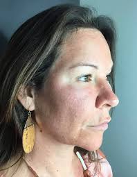 Aesthetic + Wellness Murfreesboro TN