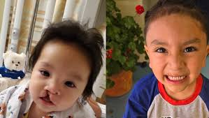 Fundraiser by Veronica Princess Mae : Support Greyson's Vital Surgery  Journey