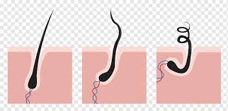 Get insights on the causes of folliculitis on scalp, legs head, ingrown hairs, treatment and how to get rid using the best infected follicles are very common and they appear as pinpoint red pimples, and in some people there is presences of a dot of pus at the tip. Capelli Hair Follicle Necrotic Hair Black Hair Text People Png Pngwing