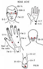Migraines Tension Headaches And Massage Acupressure Treatment Acupressure Therapy Acupressure Headache