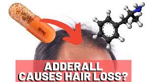 Adderall abuse can increase anxiety and stress levels. Adderall Hair Loss What S The Truth Youtube