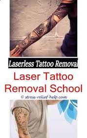 Surgical Tattoo Removal Best Tattoo Removal Neck Tattoo Removal Cost Picosure Laser Where To Get My Tat Laser Tattoo Removal Tattoo Removal Cost Laser Tattoo