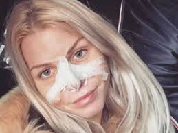 Jessica Thivenin et Thibault Kuro justifient leur chirurgie nasale commune 