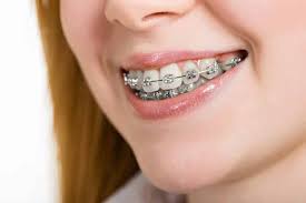 The process of cleaning your teeth. How To Stop Braces Pain Other Braces Problems Electric Teeth