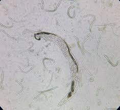 Image result for Strongyloides