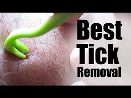 Then pull upward slowly and steadily. The Best Way To Remove An Embedded Tick Youtube