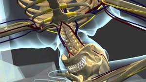 3D Accident Animation