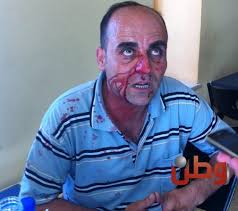 ويعتبر الناشط نزار بنات، الذي كان ينوي خوض الانتخابات وألقى نزار باللوم في الهجوم على حركة فتح التي يتزعمها الرئيس محمود عباس والتي تهيمن على قوات الأمن، قائلا إنها فقط. Ø§Ù„Ø§Ø¹ØªØ¯Ø§Ø¡ Ø¹Ù„Ù‰ Ø§Ù„Ù…Ø¯Ùˆ Ù† ÙˆØ§Ù„Ù†Ø§Ø´Ø· Ù†Ø²Ø§Ø± Ø¨Ù†Ø§Øª Ø¨Ø¹Ø¯ Ù…Ø´Ø§Ø¯Ø© Ù…Ø¹ ÙˆØ²ÙŠØ± Ø§Ù„Ø§Ù‚ØªØµØ§Ø¯ Ø§Ù„ÙÙ„Ø³Ø·ÙŠÙ†ÙŠ Ø£Ø®Ø¨Ø§Ø± Ø£Ø®Ø¨Ø§Ø± Ø³ÙƒØ§ÙŠØ² Ù…ÙŠØ¯ÙŠØ§ Ù…Ø±ÙƒØ² Ø§Ù„Ø¯ÙØ§Ø¹ Ø¹Ù† Ø§Ù„Ø­Ø±ÙŠØ§Øª Ø§Ù„Ø¥Ø¹Ù„Ø§Ù…ÙŠØ© ÙˆØ§Ù„Ø«Ù‚Ø§ÙÙŠØ©
