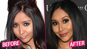 Erik hoy ­long before anyone thought to nip and tuck or even heard of. Jersey Shore Cast S Shocking Plastic Surgery Transformations Revealed