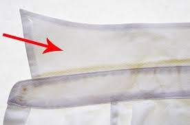 Ter lekesi nasıl çıkar diye merak edenler buna çözüm bulmak isterler. Beyazlardaki Sari Lekeler Nasil Cikar