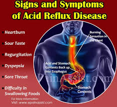 We did not find results for: Signs And Symptoms Of Acid Reflux Disease