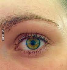 Adding To The Posts About Unique Eyes My Eye Colour Blue Ring Green Fill And Brown Highlights Girl With Green Eyes Pretty Eyes Color Eye Color