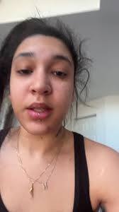 Why Does My Eye Hurt When I Side Eye