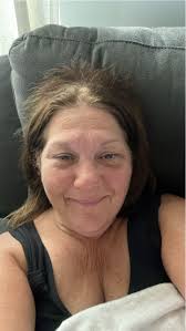 Thank you for the well wishes after surgery