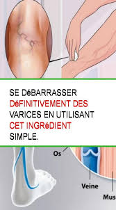 Pin On Sante