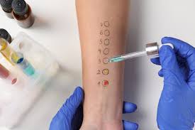 Image result for Allergy Screening