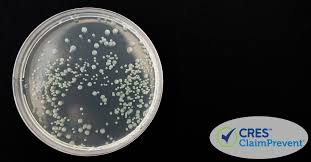 Image result for Legionella