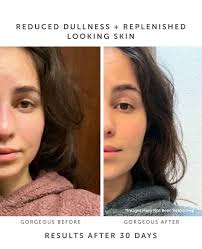 MARINA Biome Brightening Ampoule