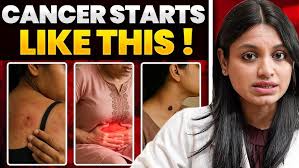 PCOS Ki Pehchan: Symptoms, Causes Aur Lifestyle Modifications Se Behtar  Zindagi