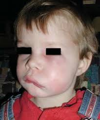 Laying the Foundation for a Healthy Life: Preventive Oral Health Care