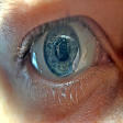 Laser Eye Surgery in Adajan, Surat product image