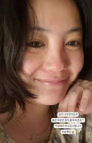 고은아, 안면부상 후 근황 많이 나아져…걱정 감사 < 연예가화제 < 연예 < 기사본문 - SPOTV NEWS