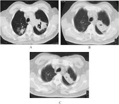 Review the total cost of your procedure with your physician. Can I Get A Ct Scan Without Insurance Ct Scan Machine