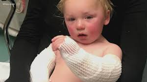Parents have warning after toddler burns himself with boiling water