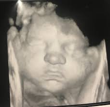 Fundraiser by Kimberlee Cartwright : Baby Emma