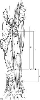 Musculus gastrocnemius) is a superficial muscle of the posterior group of the lower leg muscles. Flexor Digitorum Profundus Muscle An Overview Sciencedirect Topics