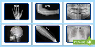human body x ray photos display resources teacher made