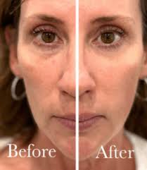 Homepage Before and Afters