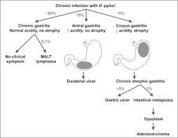 Helicobacter Pylori Infection And Gastric Carcinoma Clinical Microbiology And Infection