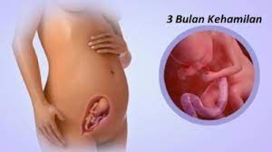 Sebaliknya, jika bumil memiliki postur tubuh yang tinggi, maka perut akan terlihat lebih menonjol ke depan. Bentuk Perut Hamil 3 Bulan Masih Rata Ini Penjelasannya