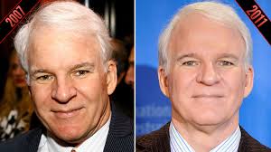 However, burt reynold only claimed about the eyelid surgery … Steve Martin Simon Cowell More Male Celebs Who May Have Had Plastic Surgery Photos