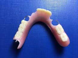 They look natural and are strong enough to handle speaking and chewing. Partial Dentures From 599 Types Benefits Cost Bob Song Denture Sydney Australia