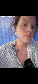 After not eating anything for 8days I finally managed to eat an egg  omelette and some small potato tot bites !! Unfortunately I couldn't  stomach the beans or veg sausage (they didn't