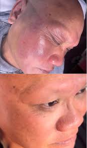 Joe Glow is a massage therapist, esthetician, and continuing education  provider from Oregon 🌲 Last weekend at The 2025 Skin Games, he  successfully defended his title of First Place in Facial Massage