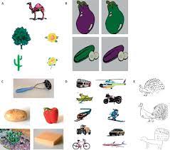 Ufhealth 4.124.566 views7 years ago. Semantic Dementia A Unique Clinicopathological Syndrome The Lancet Neurology