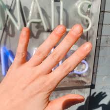 Dylan's left hand in january 2021. How To Stop Biting Your Nails Into The Gloss