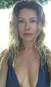 Bad face injection expeience