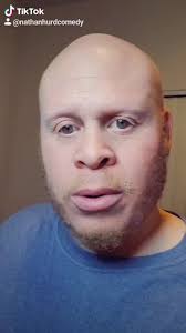 #blackalbino #comedy #jokes #fyp #laugh #funny