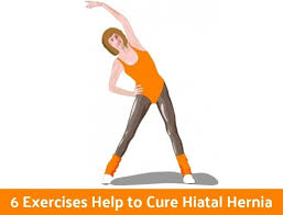 There are many kinds of hernias, and some can lead to serious problems. Can You Exercise With Hiatal Hernia Exercise