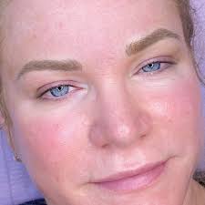 Burr Ridge, IL 60527