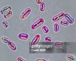 Image of bubonic plague microscopic images